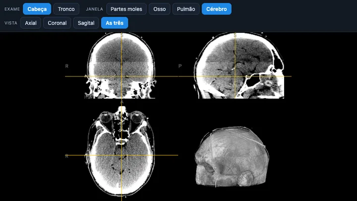 Tela da simulação Tomografia Fatia a Fatia